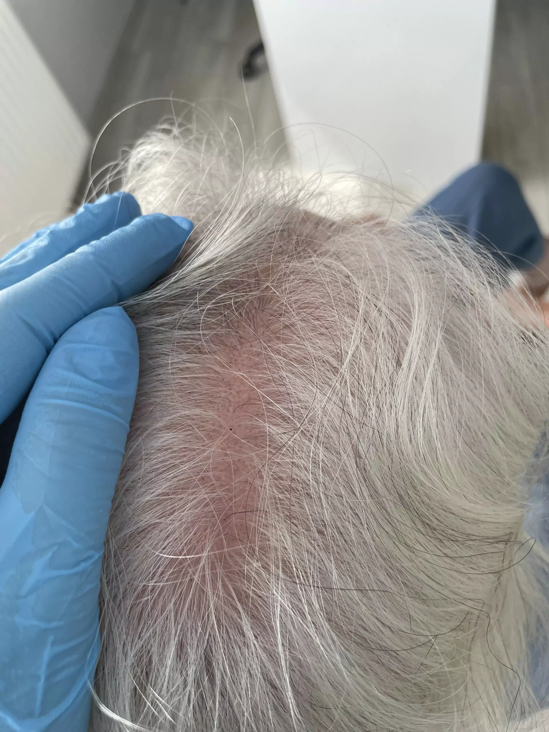 Konsultacja Trychologiczna Trycholog Bydgoszcz – Milena Kwaśniewska, specjalizuję się w diagnostyce i leczeniu problemów skóry głowy oraz włosów, oferując profesjonalne konsultacje i indywidualnie dobrane terapie. Nowa 15, 85-119 Bydgoszcz https://milena-trycholog.pl